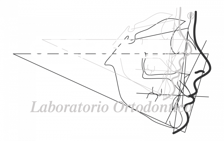 Orthofan Laboratorio Ortodontico - Logo Trasparente
