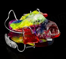 Twin Block | Apparecchi Funzionali